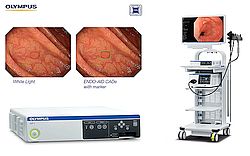 Olympus Launches ENDO-AID, an AI-Powered Platform for Its Endoscopy System