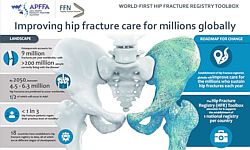 World-first Hip Fracture Registry Toolbox striving to improve care for the 1 million+ who fracture a hip in Asia Pacific each year