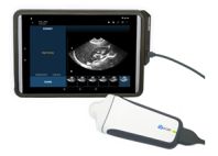 シグノスティックス、ブラッダーケアのための超音波画像診断デバイス、「Uscan(TM)」の日本市場への本格的導入と販売へ