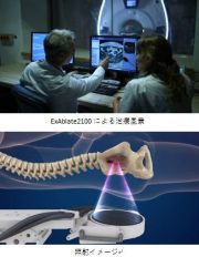 GEヘルスケア、インサイテック社との共同開発 MRガイド下集束超音波治療器「ExAblate2100」による有痛性骨転移がんの疼痛緩和治療を日本市場へ投入
