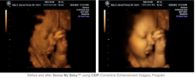 UK Laboratory Develops Amazing Fetal Ultrasound Image Technology
