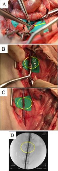 Successful Control of Bleeding by Closing Vena Cava Wound with Nanosheets 